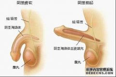 轻度阳痿有什么症状——汕头龙湖