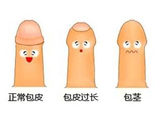 如何治疗包茎效果好?